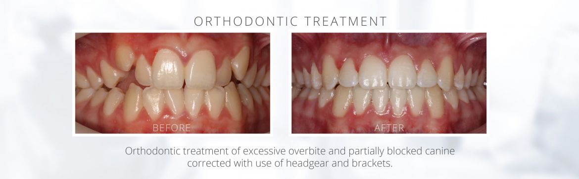 Ortho-BA2c.jpg