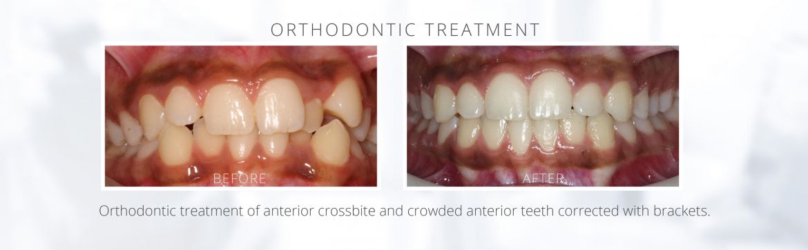 Ortho-BA3d.jpg