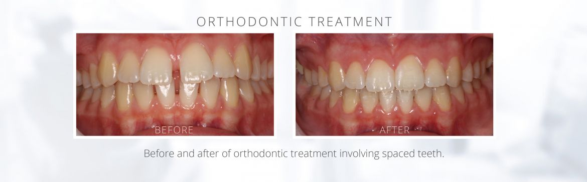 Ortho-BAa.jpg