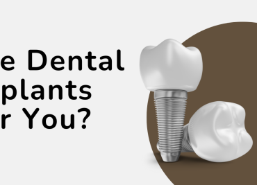Are Dental Implants Right for You? A Complete Guide