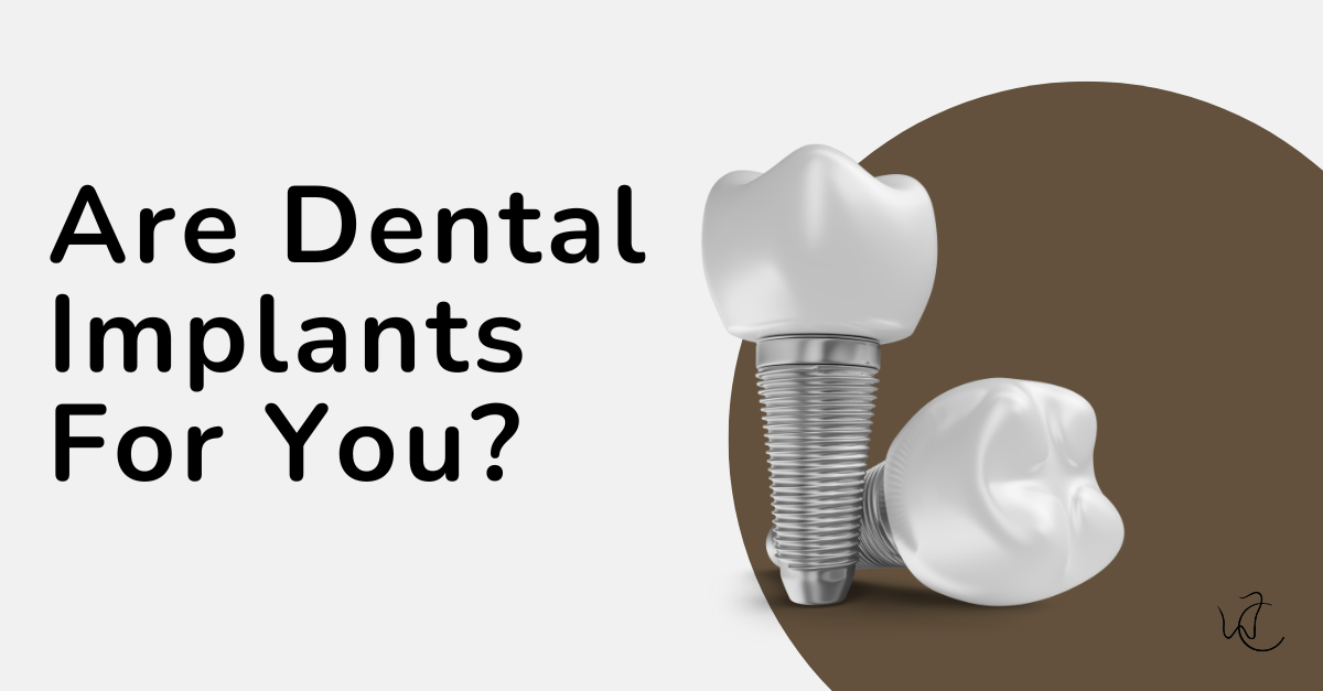 Are Dental Implants Right for You? A Complete Guide