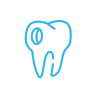 blue_Cavity.png