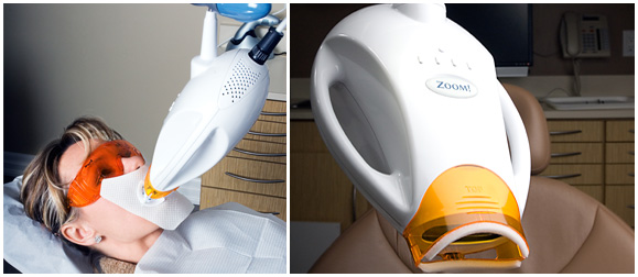 zoom-whitening.jpg